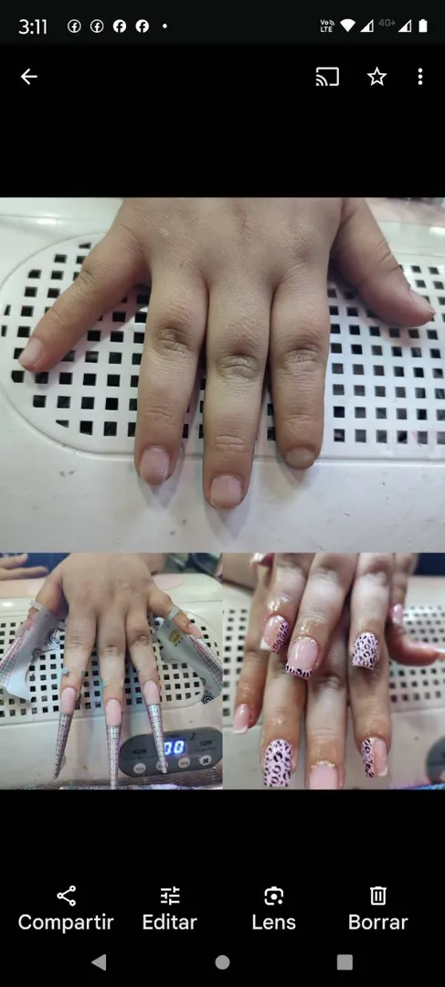 el antes durante y despuez de uñas acrilicas