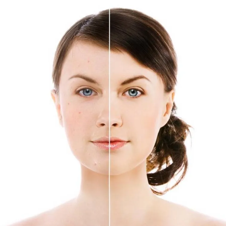 bow, syringe, brassiere