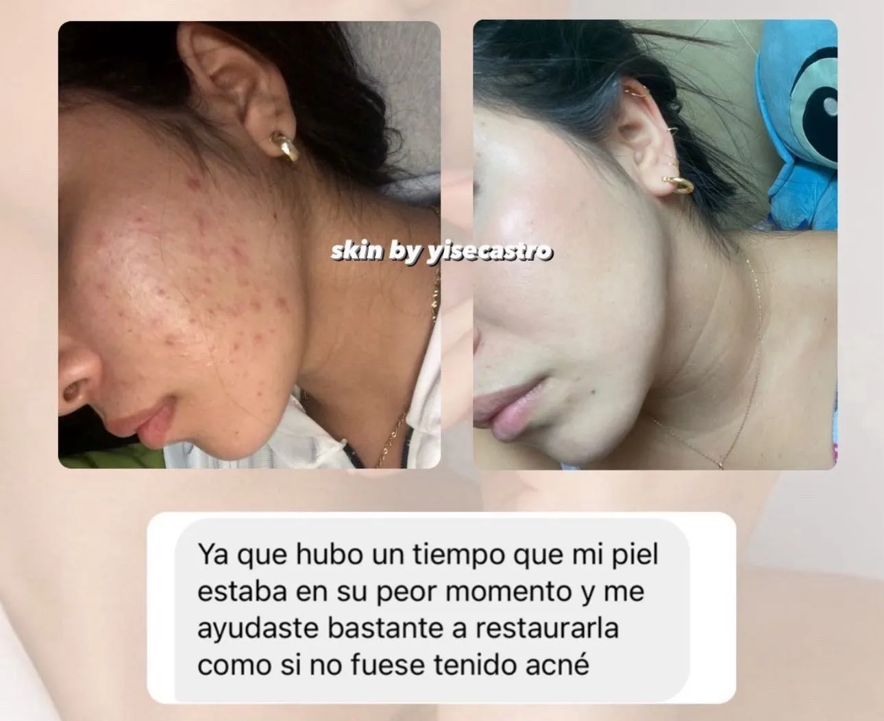 Skincare