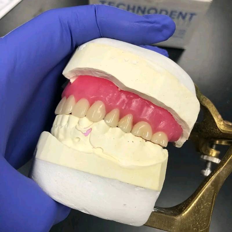 Prótesis dental