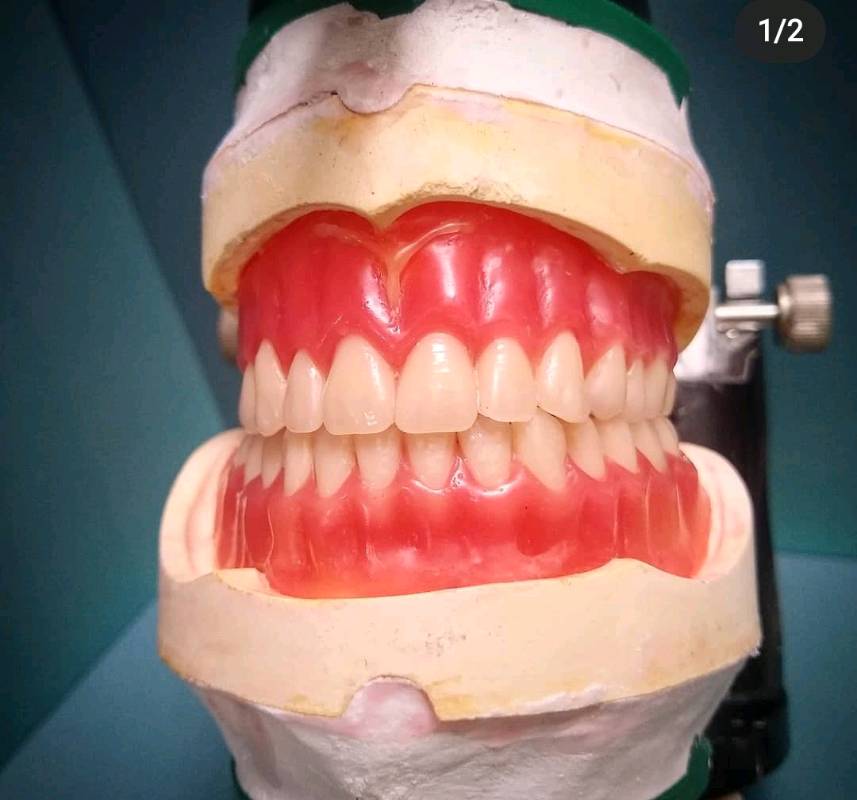 PROTESIS DENTAL