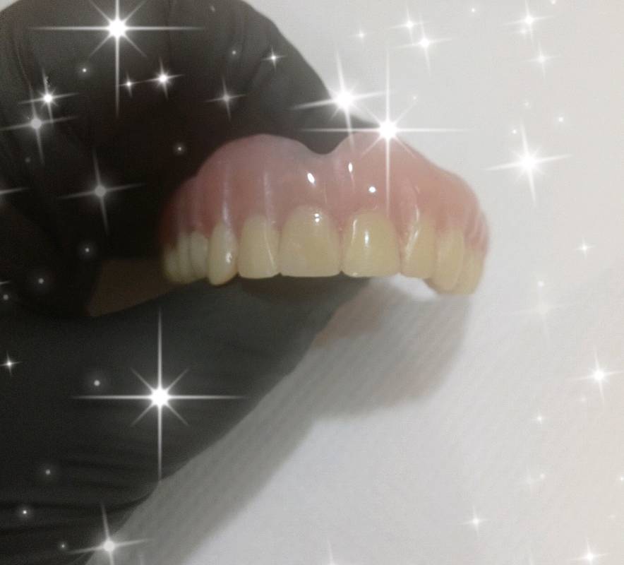 Prótesis dental