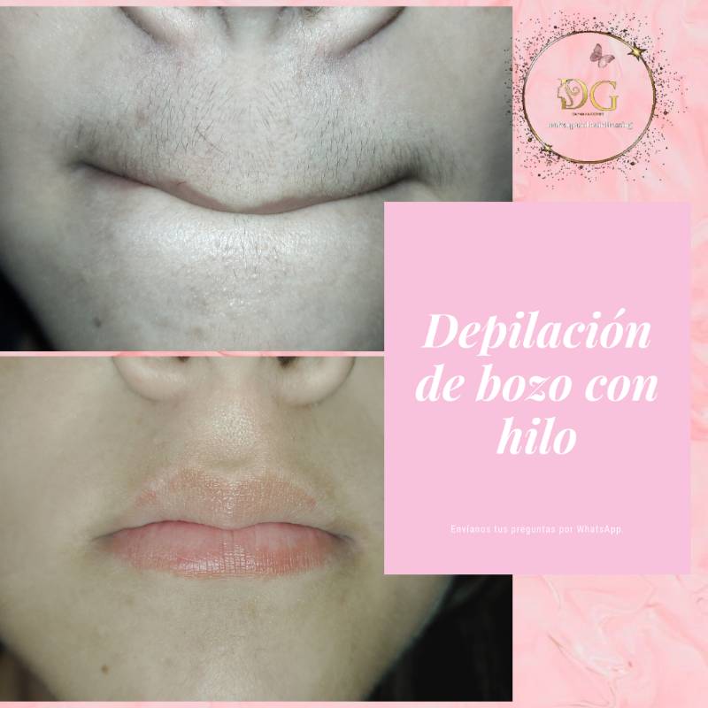 Depilacion con store hilo bozo