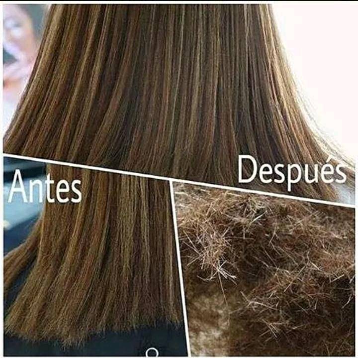 Maquina quita orzuela precio sales