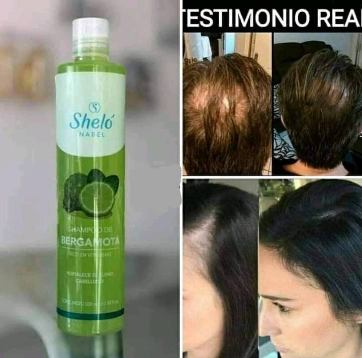 Shampoo de Bergamota con Minoxidil