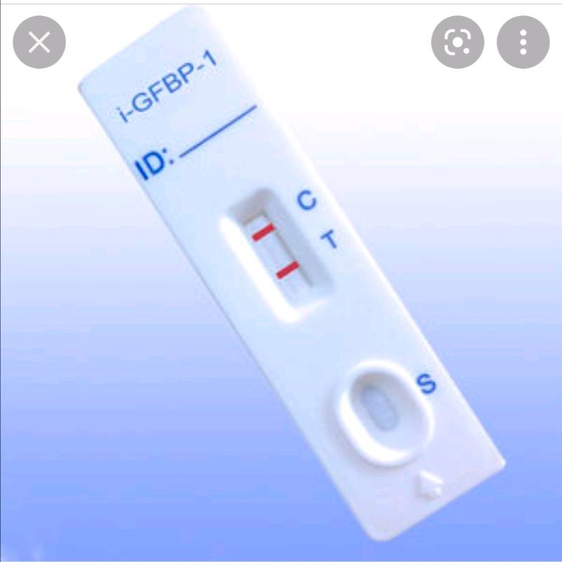 Prueba de embarazo